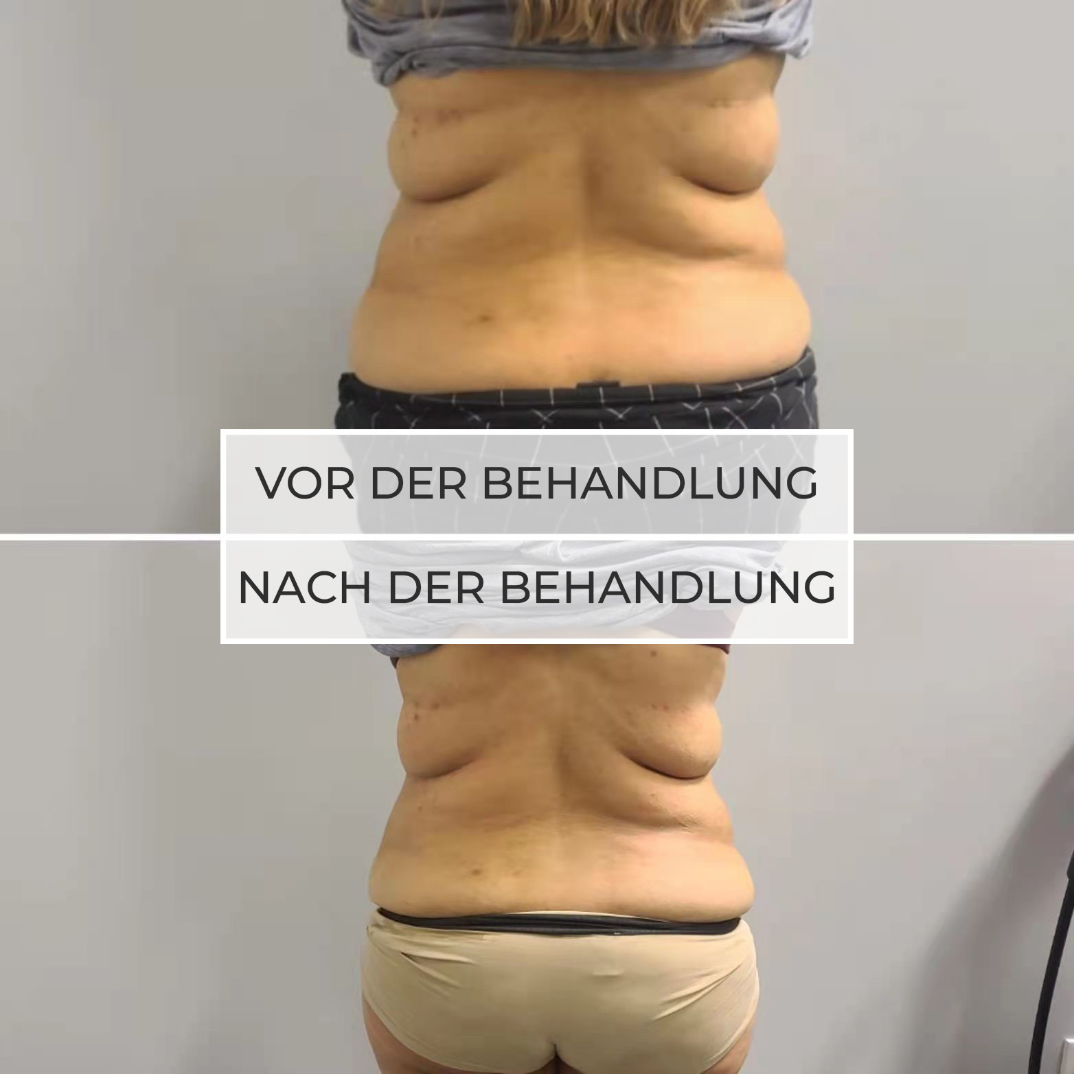 vor und nach der Behandlung vor und nach der Behandlung