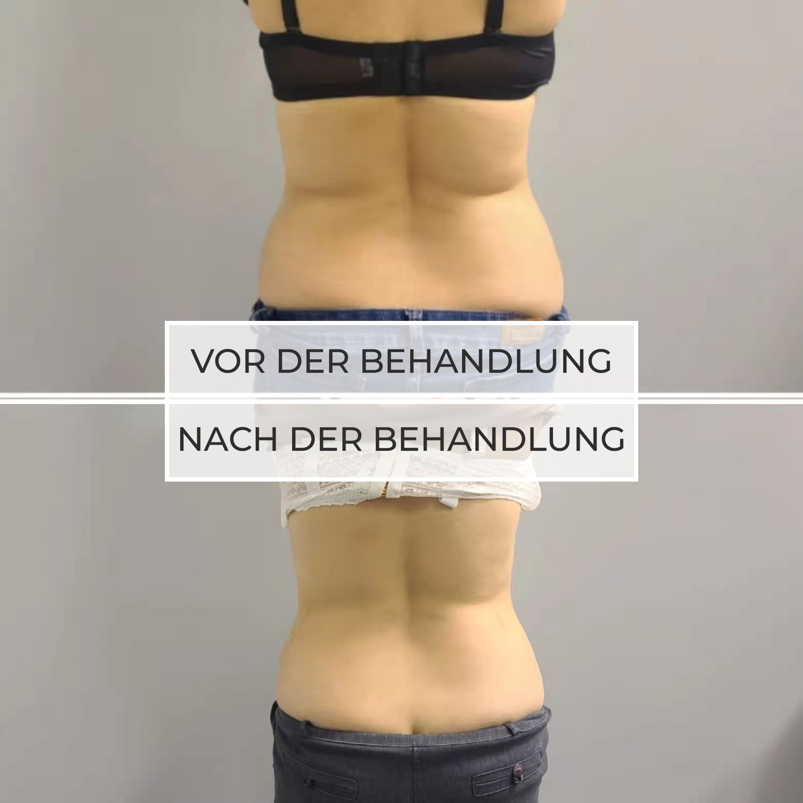 vor und nach der Behandlung vor und nach der Behandlung