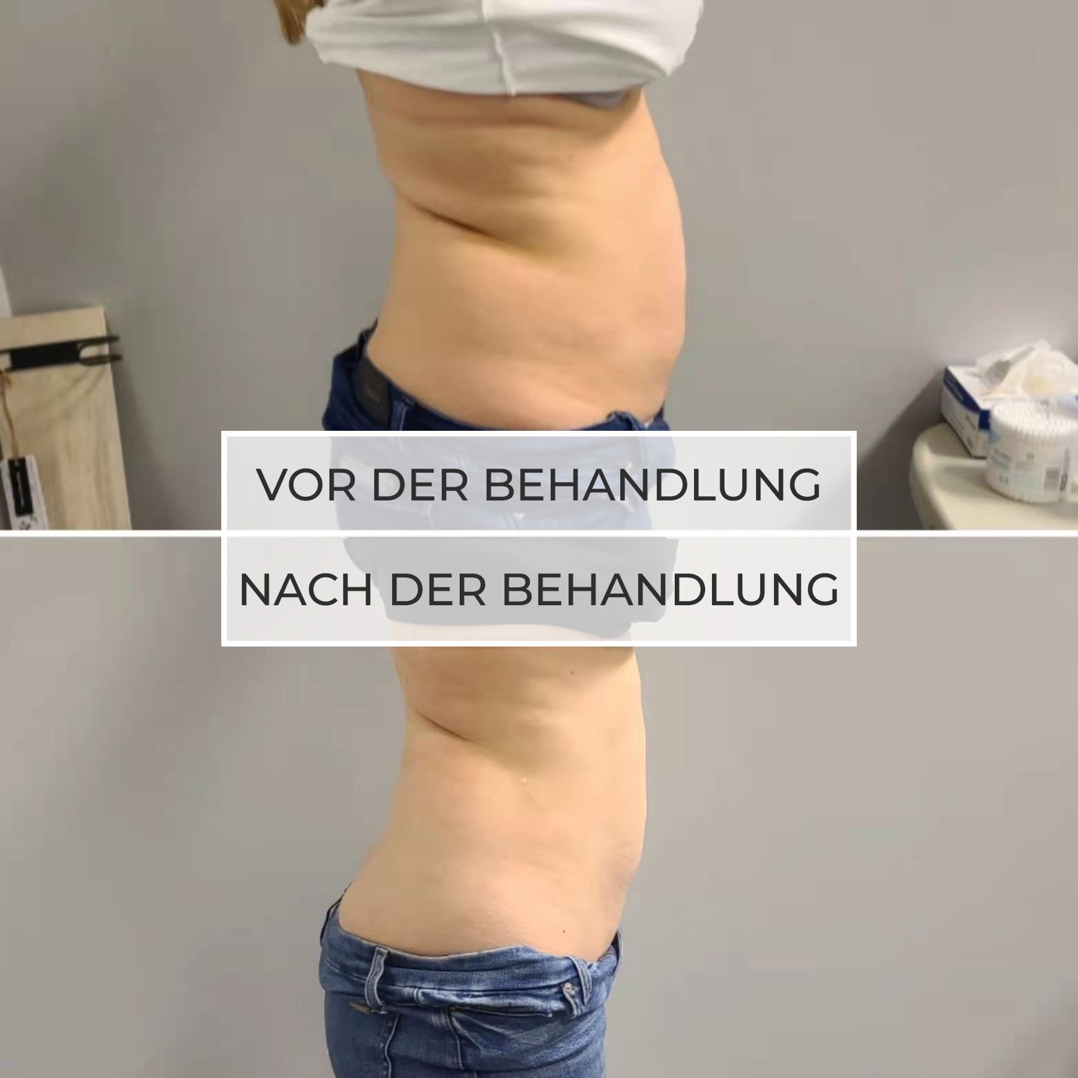 vor und nach der Behandlung vor und nach der Behandlung