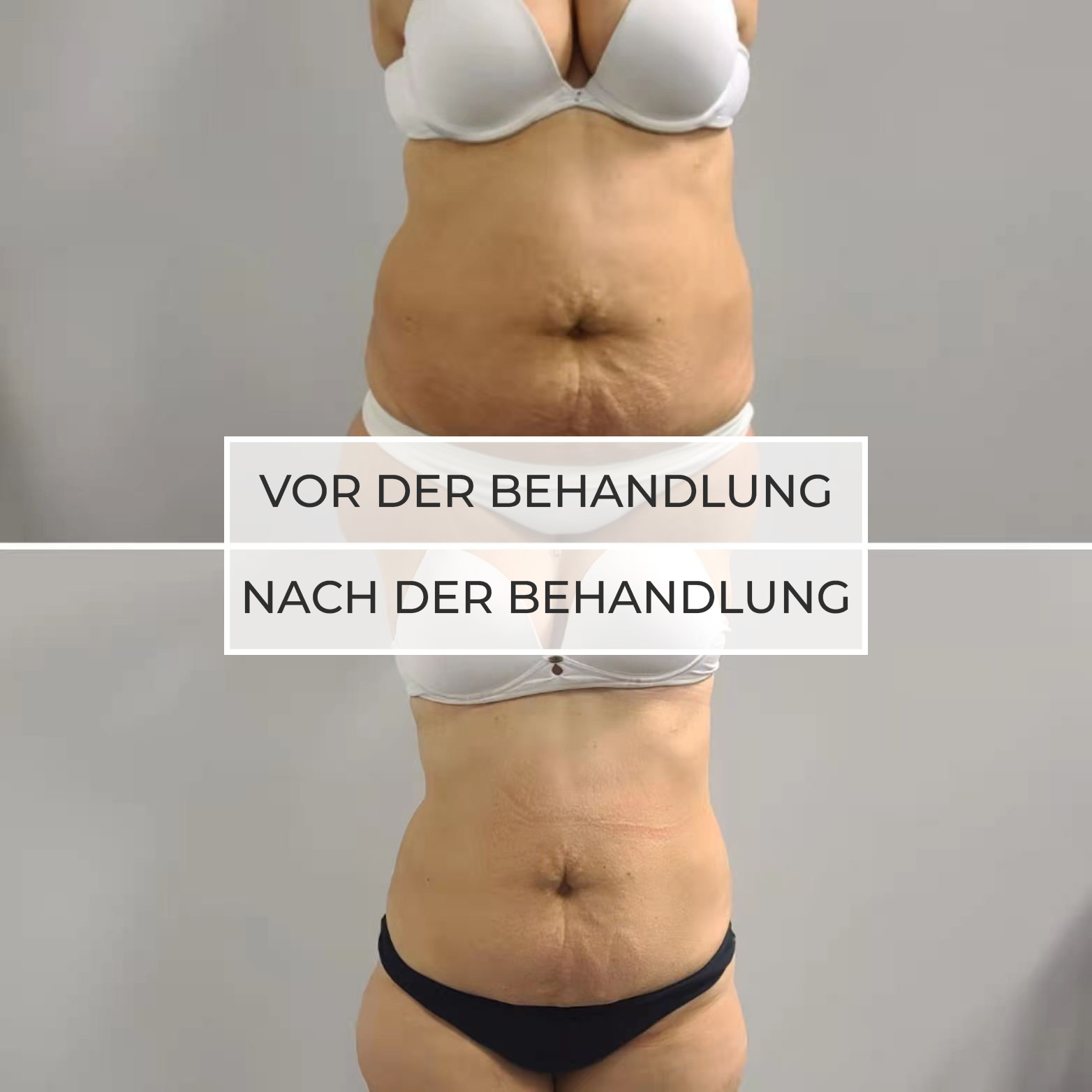 vor und nach der Behandlung vor und nach der Behandlung