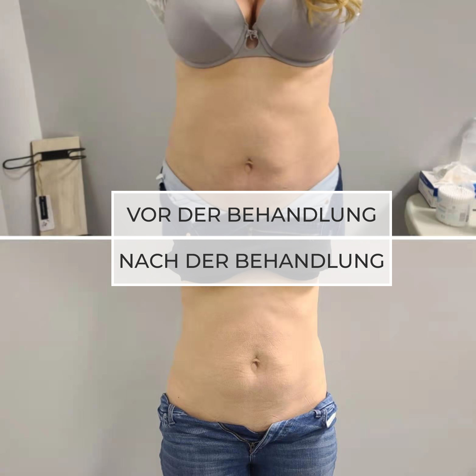 vor und nach der Behandlung vor und nach der Behandlung