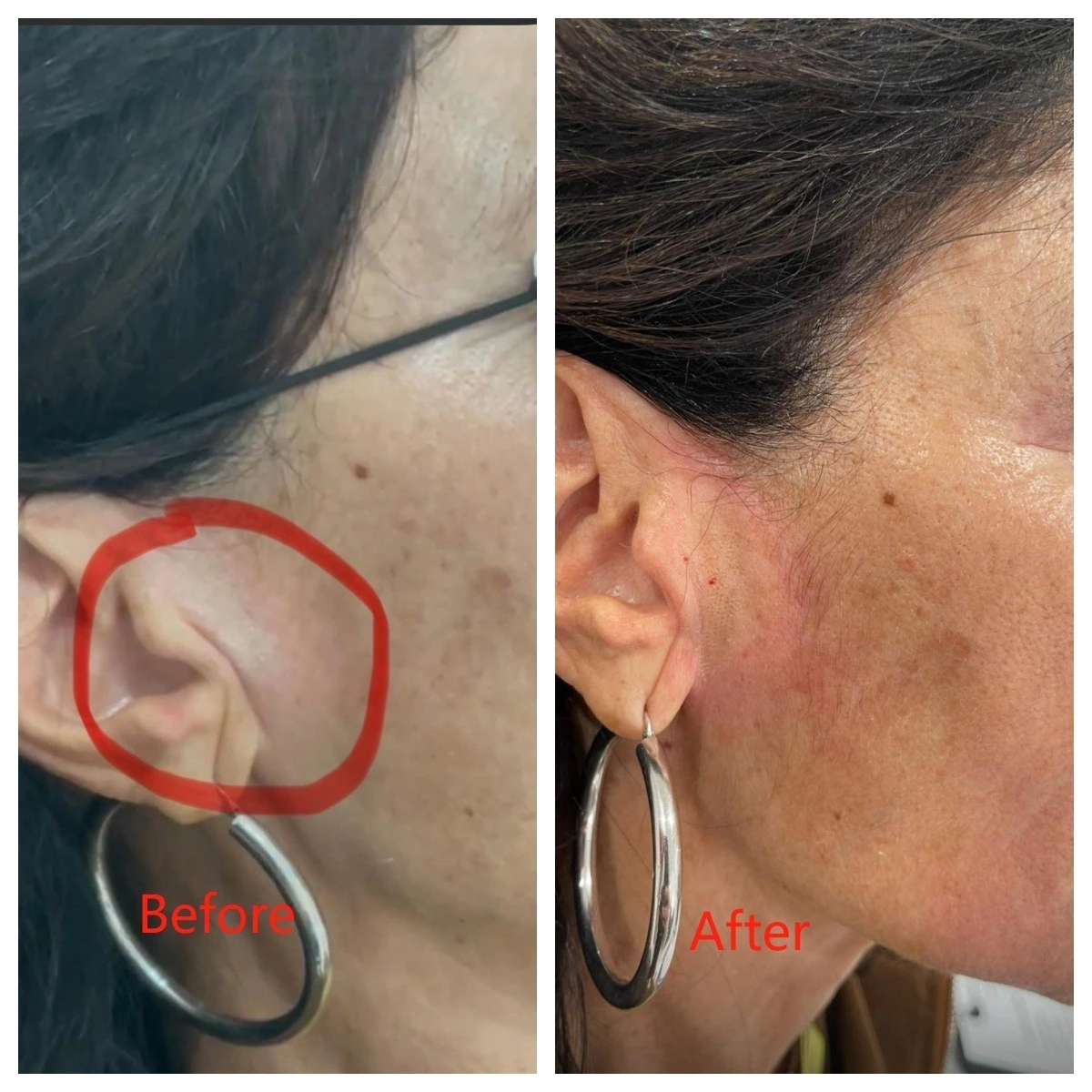 Vor und nach der Behandlung
